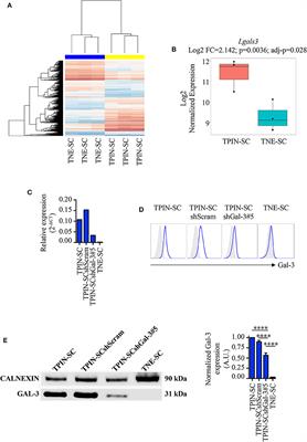 Galectin-3 in Prostate Cancer Stem-Like Cells Is Immunosuppressive and Drives Early Metastasis